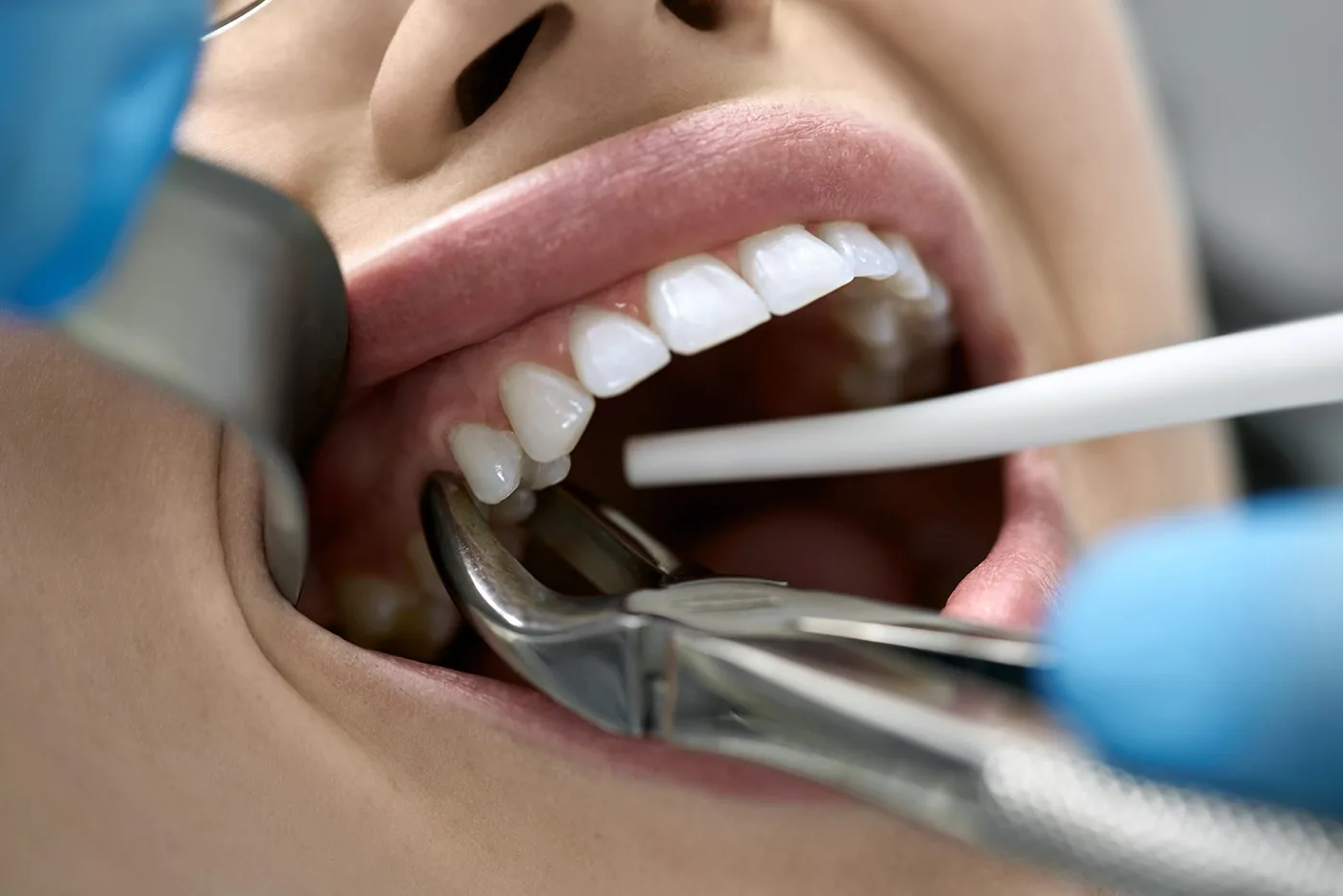 Dentist examining a patient’s teeth